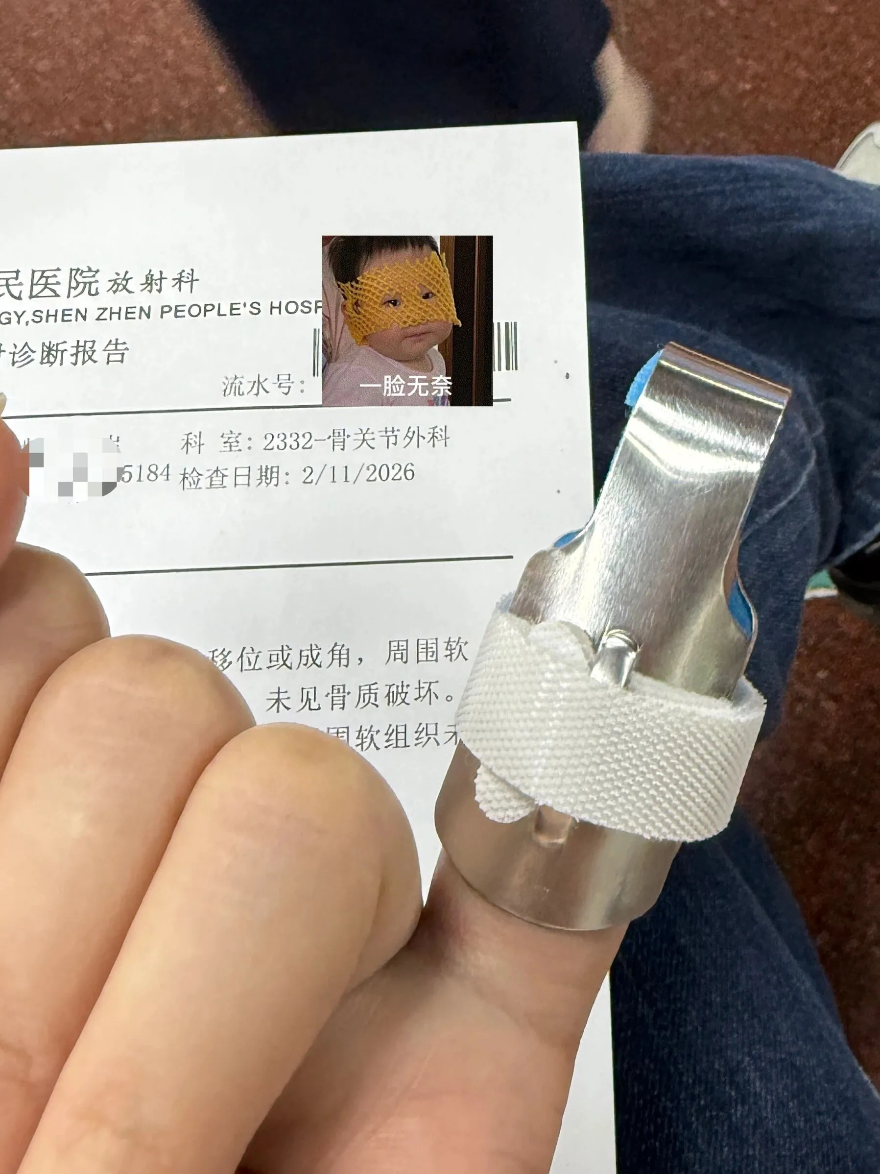 手指骨折后要怎么做